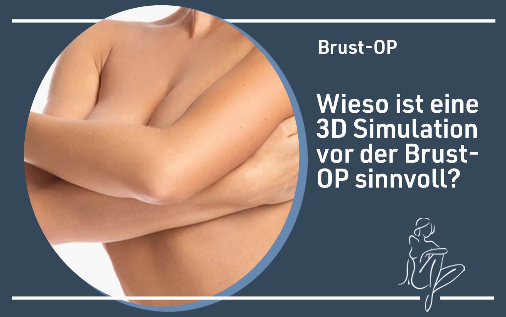 brust-op-3Dsimulation-vor-der-op-sinnvoll