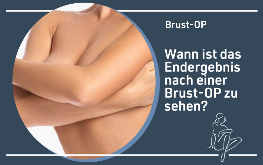 brust-op-wann-sieht-man-das-endergebnis