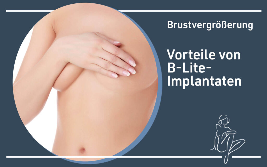 Vorteile von B-Lite-Implantaten Kassel